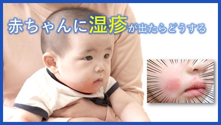 1.赤ちゃんに湿疹が出たらどうする