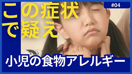 4.小児の食物アレルギー